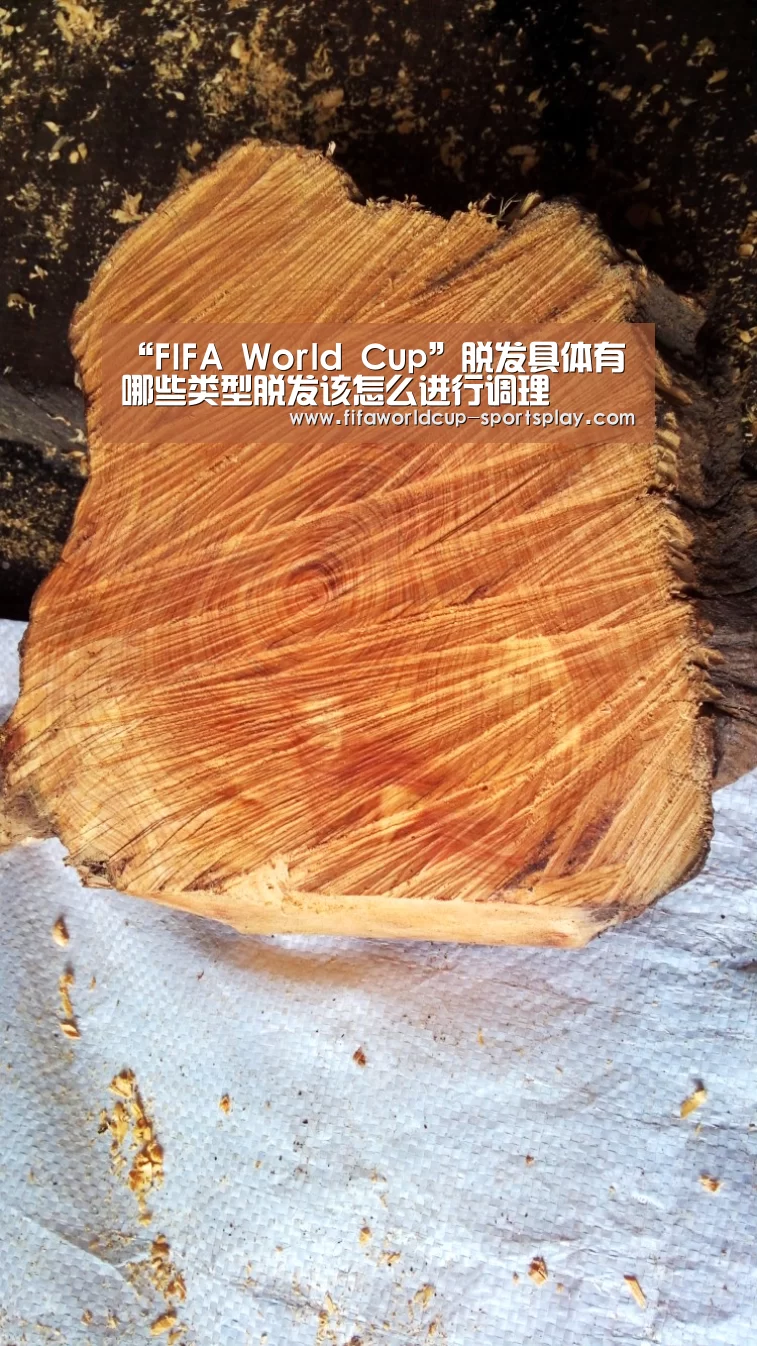 “FIFA World Cup”脱发具体有哪些类型脱发该怎么进行调理(图3) 世界杯官方入口